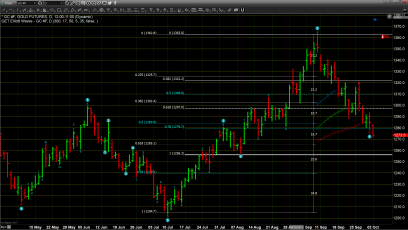 Strong Dollar Takes Gold Below Critical Support 